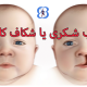 Cleft palate disease